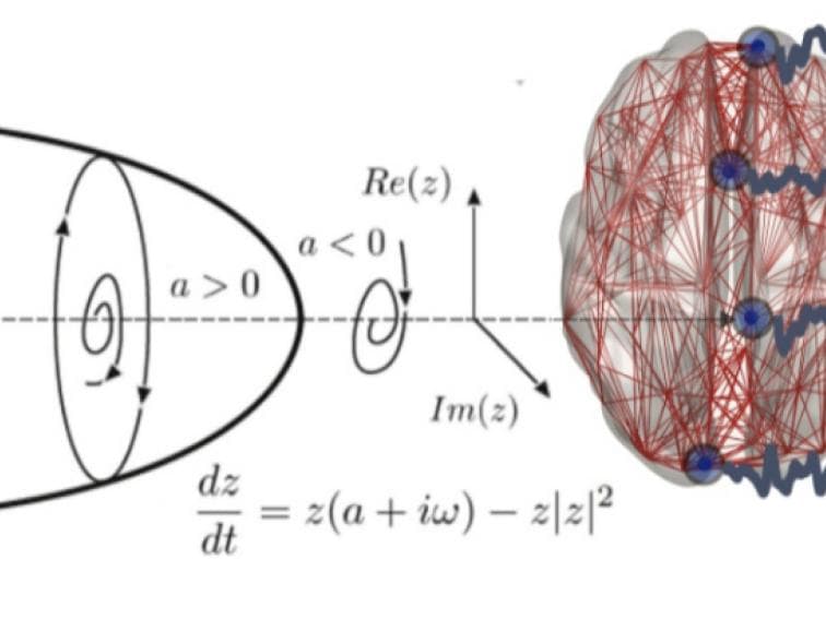 Whole-brain